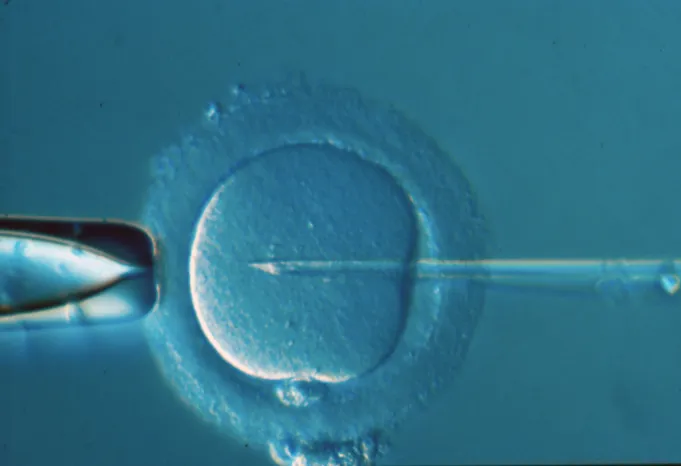 Göteborgs IVF klinik