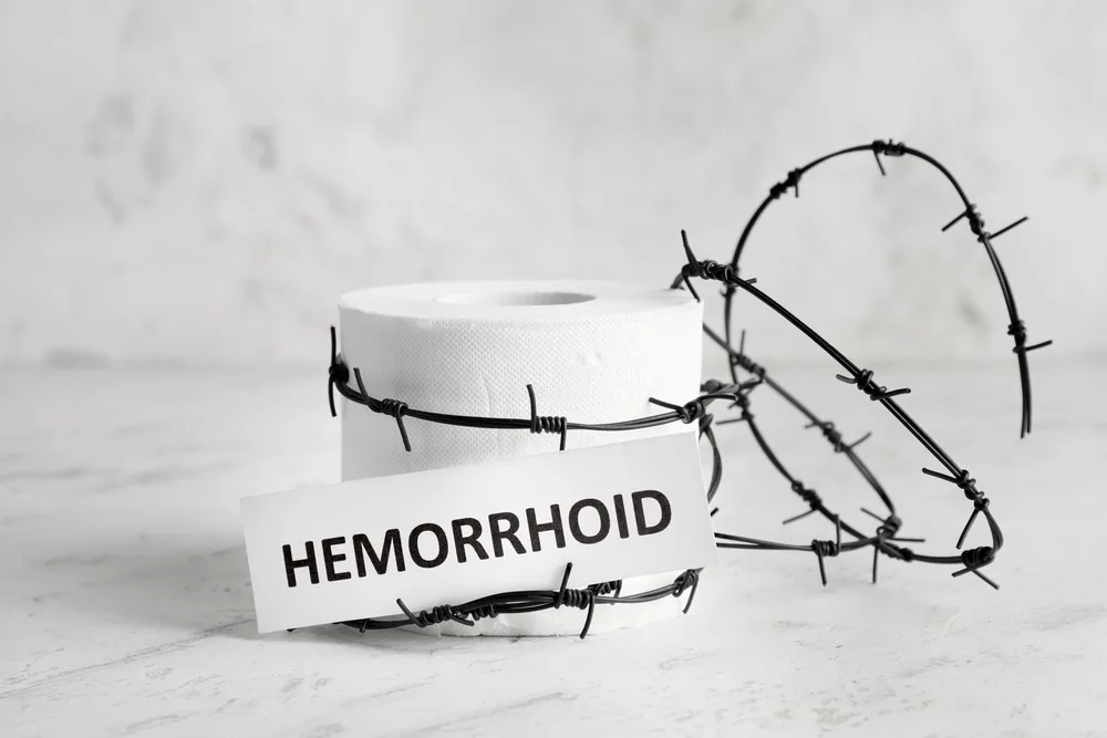 Hemorrojder illustration